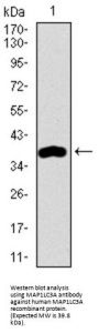 Microtubule-Associated Proteins 1A/1B Light Chain 3A (MAP1LC3A) Antibody