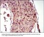 Microtubule-Associated Proteins 1A/1B Light Chain 3A (MAP1LC3A) Antibody
