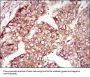 Microtubule-Associated Proteins 1A/1B Light Chain 3A (MAP1LC3A) Antibody