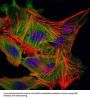 Myelin Basic Protein (MBP) Antibody
