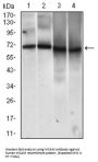 Melanoma Cell Adhesion Molecule (MCAM) Antibody