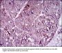 Melanoma Cell Adhesion Molecule (MCAM) Antibody