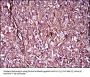 Melanoma Cell Adhesion Molecule (MCAM) Antibody