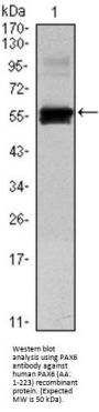 Paired Box Protein Pax-6 (PAX6) Antibody