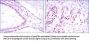 Polycomb Protein SUZ12 (SUZ12) Antibody