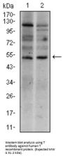 T-Box Transcription Factor T (TBXT) Antibody