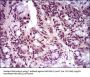 T-Box Transcription Factor T (TBXT) Antibody