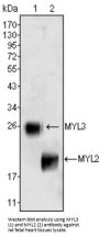 Myosin Light Chain 3 (MYL3) Antibody
