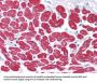 Myosin Light Chain 3 (MYL3) Antibody