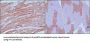 Myosin Light Chain 3 (MYL3) Antibody