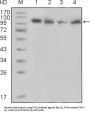 Protein-Tyrosine Kinase 2-Beta (PYK2) Antibody