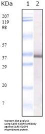 SARS-E2 Antibody