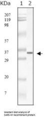 SARS-M Antibody