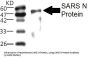 SARS N Protein Antibody