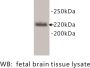 NCAM-L1/L1CAM (NCAM-L1) Antibody