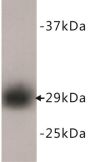 Proliferating Cell Nuclear Antigen (PCNA) Antibody