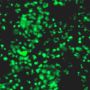 Transcription Factor SOX-2 (SOX2) Antibody