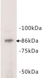 Signal Transducer And Activator of Transcription 3 (STAT3) Antibody