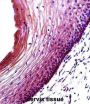 Bcl-2-Binding Component 3 (BBC3) Antibody