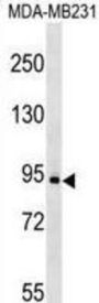Mast/Stem Cell Growth Factor Receptor Kit (KIT) Antibody