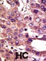 E3 Ubiquitin-Protein Ligase AMFR (AMFR) Antibody