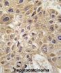 E3 Ubiquitin-Protein Ligase AMFR (AMFR) Antibody