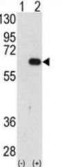 E3 Ubiquitin-Protein Ligase AMFR (AMFR) Antibody