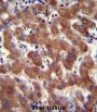 Androgen Receptor (AR) Antibody