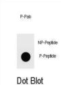 Ammonium Transporter Phospho-Thr465 Antibody