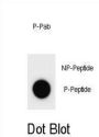 mouse p21Cip1 (pS125) Antibody