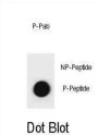 rat CCNB3 (pS284) Antibody