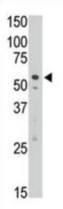 Sialic Acid Binding Ig Like Lectin 7 (SIGLEC7) Antibody