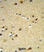 Cytochrome P450 26A1 (CYP26A1) Antibody