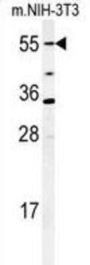 Cytochrome P450 26A1 (CYP26A1) Antibody