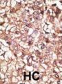 STUB1 Antibody