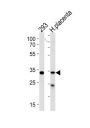 STUB1 Antibody