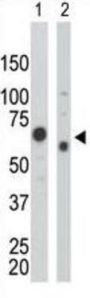 Pyruvate Kinase Antibody
