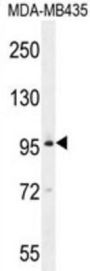 Bromodomain Testis-Specific Protein (BRDT) Antibody