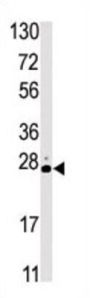 Serine/threonine-Protein Kinase 19 (STK19) Antibody