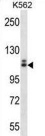 Mast/stem Cell Growth Factor Receptor Kit (c-KIT) Antibody