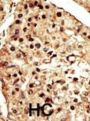 Transient Receptor Potential Cation Channel Subfamily M Member 7 (TRPM7) Antibody