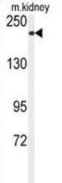 Transient Receptor Potential Cation Channel Subfamily M Member 7 (TRPM7) Antibody