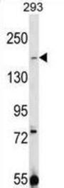 Transient Receptor Potential Cation Channel Subfamily M Member 7 (TRPM7) Antibody