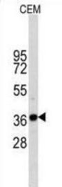 Glyceraldehyde-3-Phosphate Dehydrogenase (GAPDH) Antibody