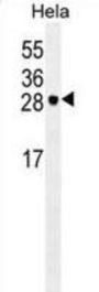 EIF4E Antibody