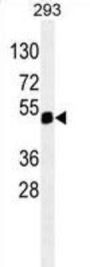 Paired Box Protein Pax-6 (PAX6) Antibody