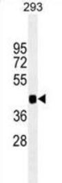 Paired Box Protein Pax-6 (PAX6) Antibody