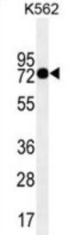 Protein-Glutamine Gamma-Glutamyltransferase 2 (TGM2) Antibody