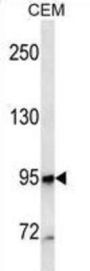 Neprilysin / NEP (MME) Antibody