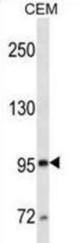 Neprilysin / NEP (MME) Antibody